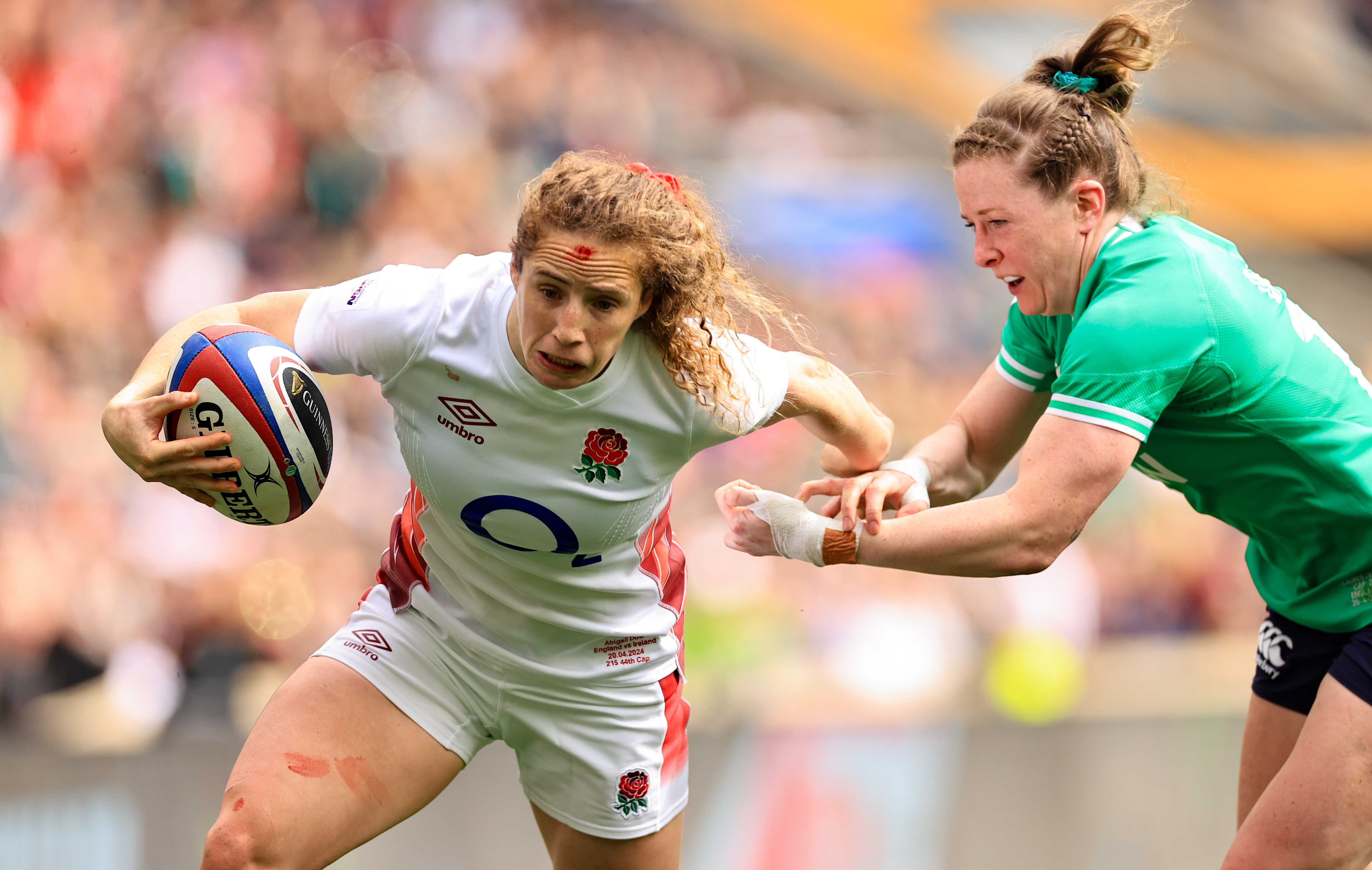 Abby Dow v Ireland 2024 W6N